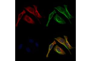 ABIN6262030 and ABIN6272943 staining 3 by IF/ICC. (GOLPH3 Antikörper  (C-Term))