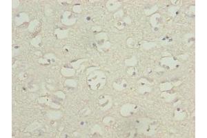 Immunohistochemistry of paraffin-embedded human brain tissue using ABIN7171598 at dilution of 1:100 (TBC1D14 Antikörper  (AA 136-435))