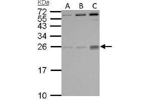 WB Image PLGF antibody detects PGF protein by Western blot analysis. (PLGF Antikörper)