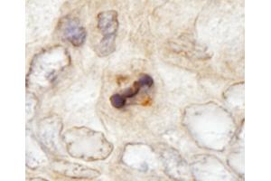 Immunohistochemistry (IHC) image for anti-Centromere Protein F (CENPF) (AA 2350-2400) antibody (ABIN7448938) (CENPF Antikörper  (AA 2350-2400))