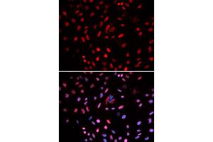 Immunofluorescence analysis of U2OS cells using POLD1 antibody. (POLD1 Antikörper)