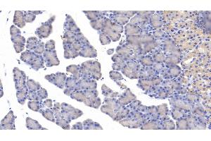 Detection of MYH11 in Rat Pancreas Tissue using Polyclonal Antibody to Myosin Heavy Chain 11, Smooth Muscle (MYH11) (MYH11 Antikörper  (AA 1-351))