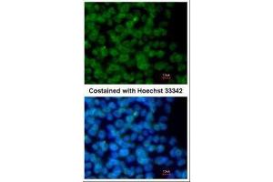 ICC/IF Image Immunofluorescence analysis of methanol-fixed mouse ESC, using ZNF198, antibody at 1:500 dilution. (ZMYM2 Antikörper  (Center))