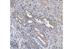 IHC analysis of PDLIM7 using anti-PDLIM7 antibody (ABIN7601048). (PDLIM7 Antikörper  (AA 275-457))