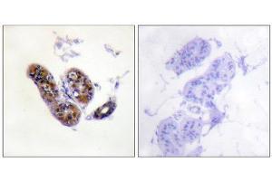 Immunohistochemistry (IHC) image for anti-Microphthalmia-Associated Transcription Factor (MITF) (Ser180), (Ser73) antibody (ABIN1847958) (MITF Antikörper  (Ser73, Ser180))