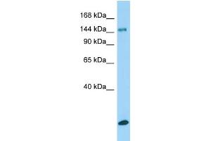 Host:  Rabbit  Target Name:  Col15a1  Sample Type:  Rat Testis lysates  Antibody Dilution:  1. (COL15A1 Antikörper  (Middle Region))
