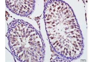 Immunohistochemistry (Paraffin-embedded Sections) (IHC (p)) image for anti-Mitofusin 1 (MFN1) (AA 651-741) antibody (ABIN670071)