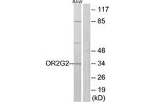 Western blot analysis of extracts from RAW264. (OR2G2 Antikörper  (AA 241-290))