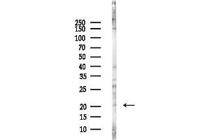anti-Ubiquitin-Conjugating Enzyme E2F (UBE2F) antibody