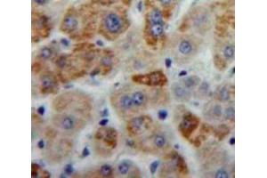 IHC-P analysis of Liver tissue, with DAB staining. (ANXA6 Antikörper  (AA 251-504))