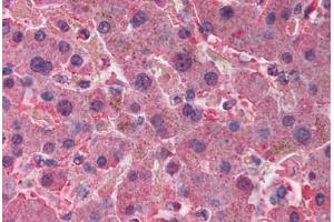 Human Liver (formalin-fixed, paraffin-embedded) stained with AHSG antibody ABIN291878 at 2. (Fetuin A Antikörper)