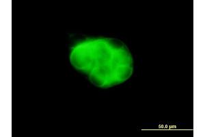 Immunofluorescence of monoclonal antibody to DCAKD on MCF-7 cell. (DCAKD Antikörper  (AA 113-200))