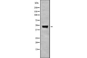 Western blot analysis ABHD3 using K562 whole cell lysates. (ABHD3 Antikörper)