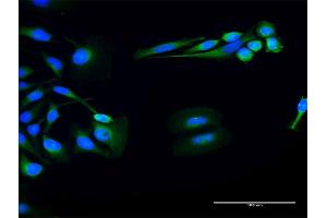 Immunofluorescence of purified MaxPab antibody to FUK on HeLa cell.