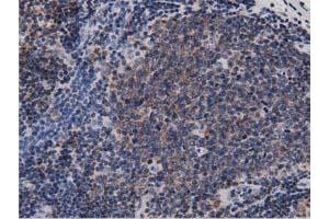 Immunohistochemical staining of paraffin-embedded Human colon tissue using anti-DNAJA2 mouse monoclonal antibody. (DNAJA2 Antikörper)