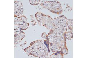 Immunohistochemistry of paraffin-embedded human placenta using PI3 Kinase p85 beta antibody (ABIN7269320) at dilution of 1:200 (40x lens). (PIK3R2 Antikörper)