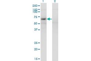 Western Blot analysis of MAGEB6 expression in transfected 293T cell line by MAGEB6 monoclonal antibody (M02), clone 2C11. (MAGEB6 Antikörper  (AA 135-244))