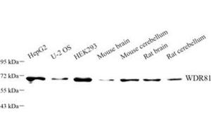 Western blot analysis of WDR81 (ABIN7076221) at dilution of 1: 1000 (WDR81 Antikörper)