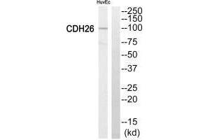 Western blot analysis of extracts from HuvEc cells, using Cytochrome P450 2C8 antiobdy. (CYP2C8 Antikörper)