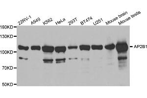 Western blot analysis of extracts of various cell lines, using AP2B1 antibody (ABIN5971039) at 1/1000 dilution. (AP2B1 Antikörper)