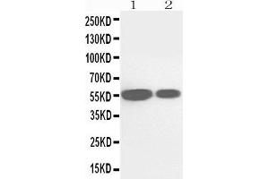 Anti-Cytochrome P450 2E1 antibody, Western blotting Lane 1: Rat Liver Tissue Lysate Lane 2: Mouse Liver Tissue Lysate