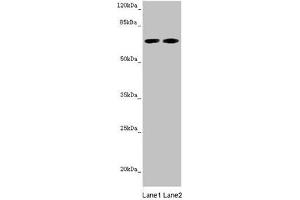 Western blot All lanes: STXBP2 antibody at 5. (STXBP2 Antikörper  (AA 1-280))