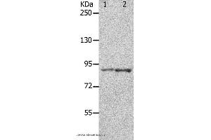 Western blot analysis of 293T cell and mouse brain tissue, using KCNC3 Polyclonal Antibody at dilution of 1:300 (KCNC3 Antikörper)