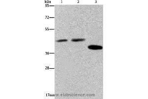 Western blot analysis of Hela, 293T and LO2 cell, using SERPINB3 Polyclonal Antibody at dilution of 1:400 (SERPINB3 Antikörper)
