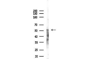 Western blot analysis of lysates from A2780 cells(starvation, 24h treatment), using Phospho-p53 (Ser6) Antibody at 1/1000 dilution.
