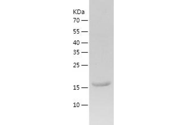 SSR1 Protein (AA 22-207) (His tag)