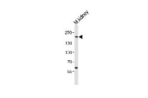 Western blot analysis of lysate from mouse kidney tissue lysate, using Erbb2 Antibody  (ABIN6243606 and ABIN6577675). (ErbB2/Her2 Antikörper  (AA 1142-1176))