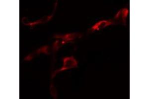 Immunofluorescence (fixed cells) (IF/ICC) image for anti-Collagen, Type VI, alpha 2 (COL6A2) (Internal Region) antibody (ABIN6257110)