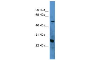 WB Suggested Anti-C1QA Antibody Titration: 0. (C1QA Antikörper  (N-Term))