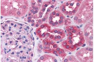Immunohistochemistry (IHC) image for anti-Signal Transducer and Activator of Transcription 6, Interleukin-4 Induced (STAT6) (AA 614-663) antibody (ABIN6745701)