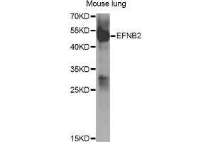 Western blot analysis of extracts of mouse lung, using EFNB2 antibody (ABIN5973311) at 1/1000 dilution. (Ephrin B2 Antikörper)