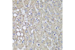 Immunohistochemistry of paraffin-embedded human liver injury using PIK3C2A antibody (ABIN5995585) at dilution of 1/100 (40x lens). (PIK3C2A Antikörper)