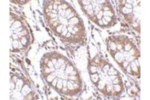 Immunohistochemistry of PTK7 in human colon tissue with PTK7 polyclonal antibody  at 2.