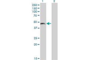 Western Blot analysis of PHF7 expression in transfected 293T cell line by PHF7 monoclonal antibody (M13), clone 3F3. (PHF7 Antikörper  (AA 258-357))