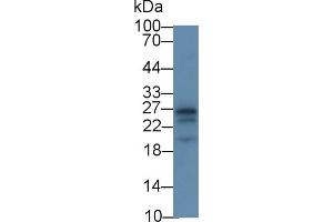 Detection of APOA1 in Rat Cerebrum lysate using Monoclonal Antibody to Apolipoprotein A1 (APOA1) (APOA1 Antikörper  (AA 122-267))