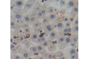 Used in DAB staining on fromalin fixed paraffin- embedded Kidney tissue (Poliovirus Receptor Antikörper  (AA 22-255))
