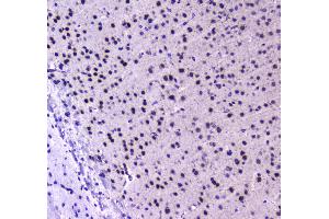 Immunohistochemistry (IHC) image for anti-Runt-Related Transcription Factor 1, Translocated To, 1 (Cyclin D-Related) (RUNX1T1) (AA 335-510) antibody (ABIN5693284)