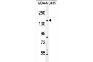 Western blot analysis in MDA-MB435 cell line lysates (35ug/lane). (CAMSAP1 Antikörper  (N-Term))