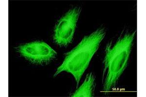 Immunofluorescence of monoclonal antibody to TUBB2A on HeLa cell.