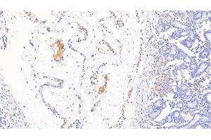Immunohistochemistry (IHC) image for anti-Hemoglobin antibody (ABIN7437245)
