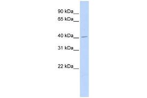 ASAHL antibody used at 1 ug/ml to detect target protein. (NAAA Antikörper  (Middle Region))