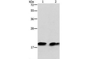 Western Blot analysis of Mouse brain tissue and NIH/3T3 cell using SKP1 Polyclonal Antibody at dilution of 1:550 (SKP1 Antikörper)