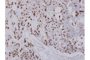 Immunohistochemistry (IHC) image for anti-Transcription Factor 25 (Basic Helix-Loop-Helix) (TCF25) (C-Term) antibody (ABIN2855291)