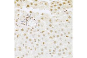 Immunohistochemistry of paraffin-embedded rat liver using SFN Antibody. (14-3-3 sigma/SFN Antikörper  (AA 1-248))