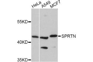 Western blot analysis of extracts of various cell lines, using SPRTN Antibody (ABIN5998942) at 1:3000 dilution. (Spartan Antikörper)