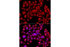 Immunofluorescence analysis of A549 cells using PIP4K2B antibody. (PIP4K2B Antikörper)